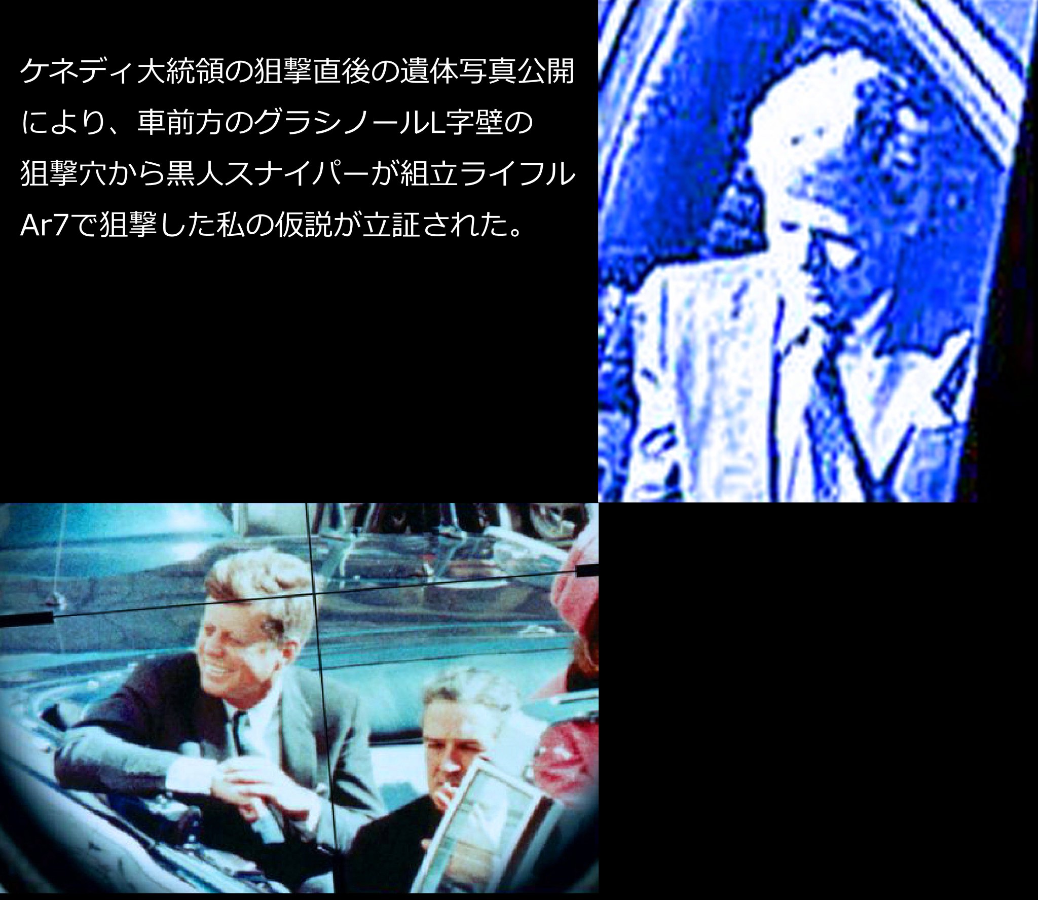 片山徹 Jf暗殺事件解決 ケネディ大統領の狙撃直後の遺体写真公開により リンカーン コンチネンタル前方のグラシーノルl字壁から黒人スナイパーroy Edward Lewisが組立ライフルar7で狙撃した私説を立証 スナイパーはジョージwブッシュの妻ローラと高校