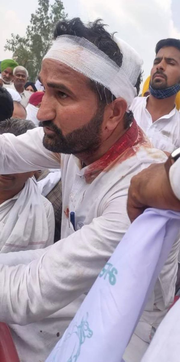 vinodkapri's tweet photo. मारो !! मारो !! किसान ही तो है।खूनमखून कर दो।घेरकर घेरकर मारो। सुरक्षा घेरा बस कंगना के लिए बचा कर रखो। https://t.co/bpxT2Gxnk0