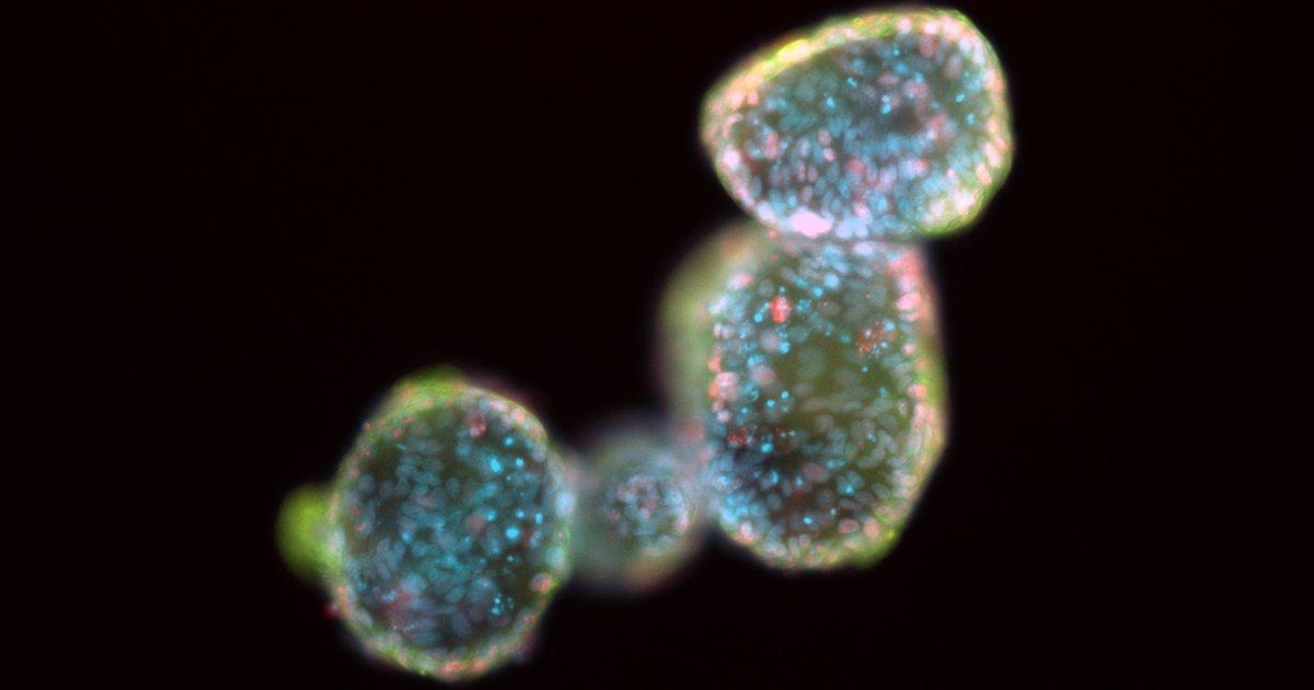 officialatcc's tweet photo. We have added a new #organoid derived from the pancreas to our #HCMI collection. This 3D microtissue can aid researchers in drug development and compound screening. Learn more about this new model: https://t.co/Pmg3RSJJKh https://t.co/xNzWbQrztr