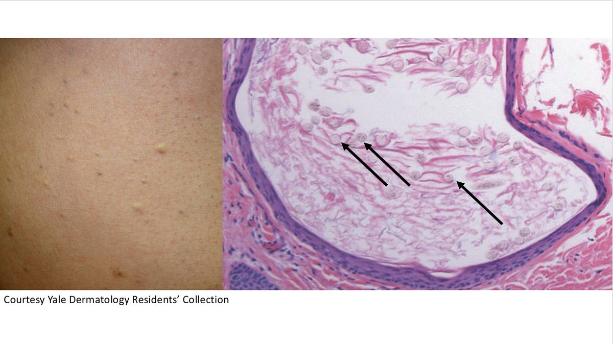 Christine J. Ko, MD tweet media