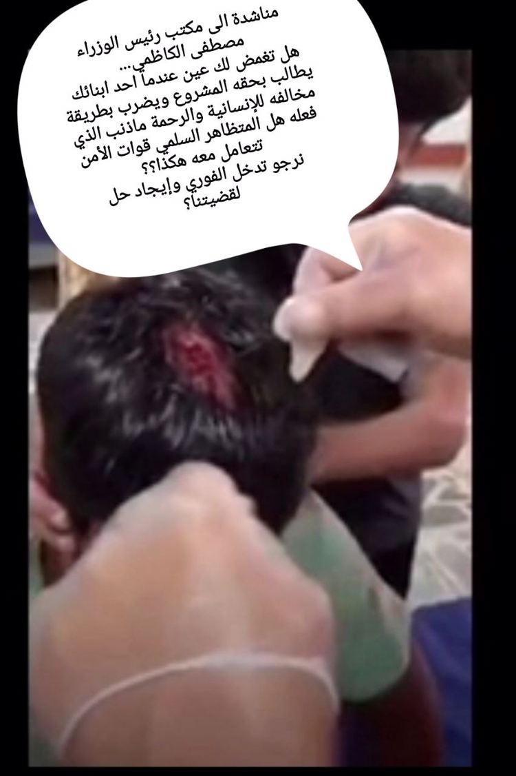 abdallah_adeeb's tweet photo. حسبي الله ونعم الوكيل ع كل من مد ايده ع شبابنا يارب احنه بحمايتك وحفظك انصرنا ياالله🙏❤
@MAKadhimi 
#مهندسين_الكهرباء_يقمعون_دولة_الرئيس https://t.co/z48kMKaI5o