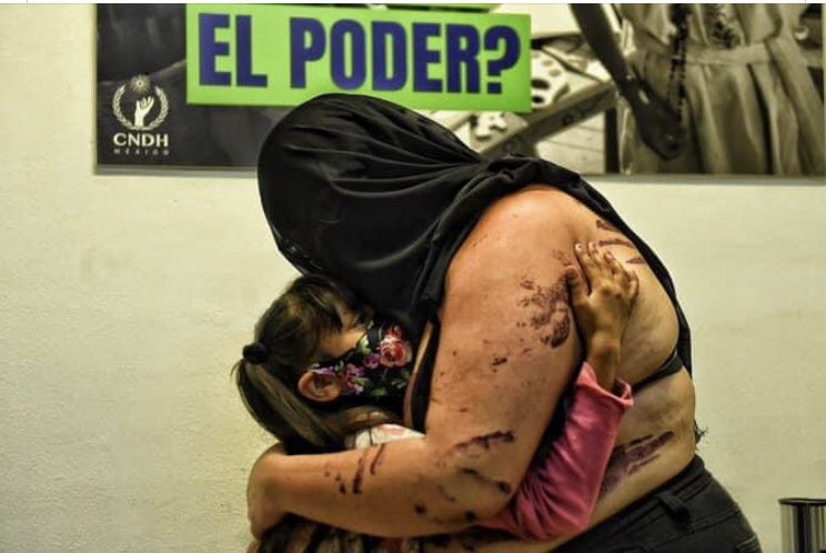 CastelloPRD's tweet photo. La toma de la CNDH por mujeres que ya no suplican pacientes que haya justicia,la exigen a gritos,con dolor en la garganta y vacíos en sus corazones;exhibe la indolencia de @lopezobrador_ y alerta a la sociedad ¡Basta de proteger al machismo criminal desde el poder! #CNDHsinPiedra https://t.co/x1asuShRKL