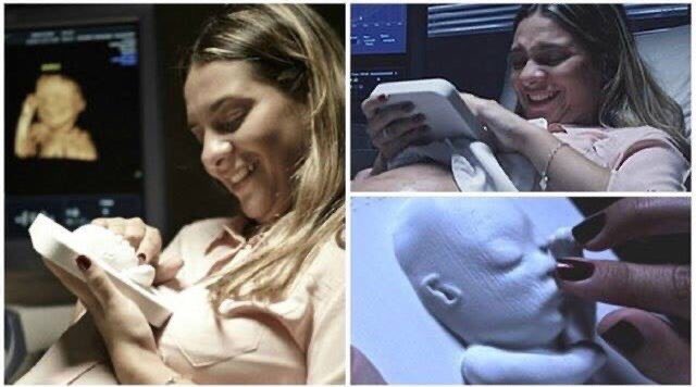bati_acl's tweet photo. Échographie en 3D pour une mère aveugle https://t.co/Z0jfbfNdSP