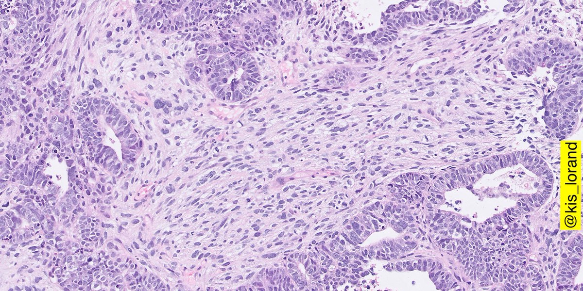 last piece of the puzzle... looking further around on the slide one finds such areas now you know it 