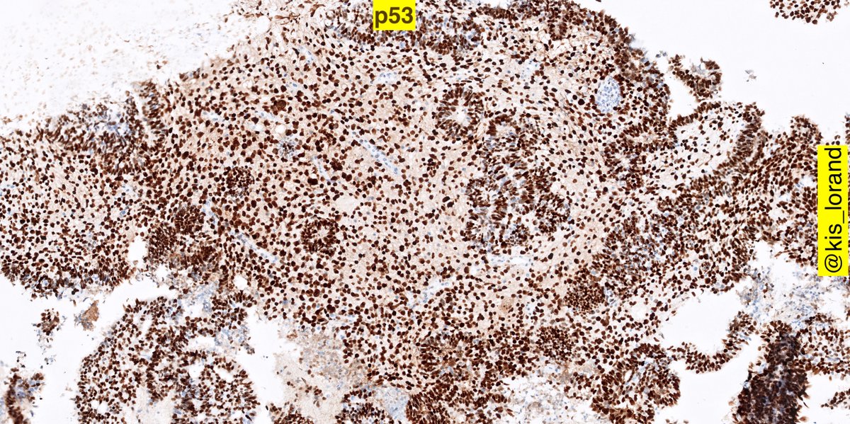 last piece of the puzzle... looking further around on the slide one finds such areas now you know it 