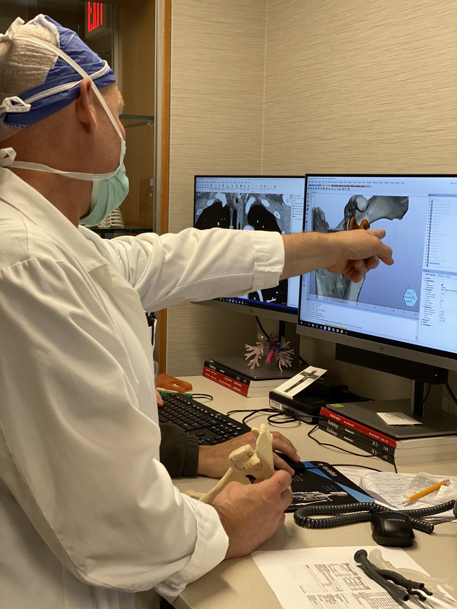 JayMorris_MD's tweet photo. Engineers becoming part of the clinical team makes treatments possible in real time. @hunterdickens9 works closely w/ Dr Mark Morrey @MayoOrtho to provide custom #3Dprinted surgical guides for complex #shoulder reconstructions manufactured in house. #orthotwitter @MayoInnovation https://t.co/2AGDqUufqy