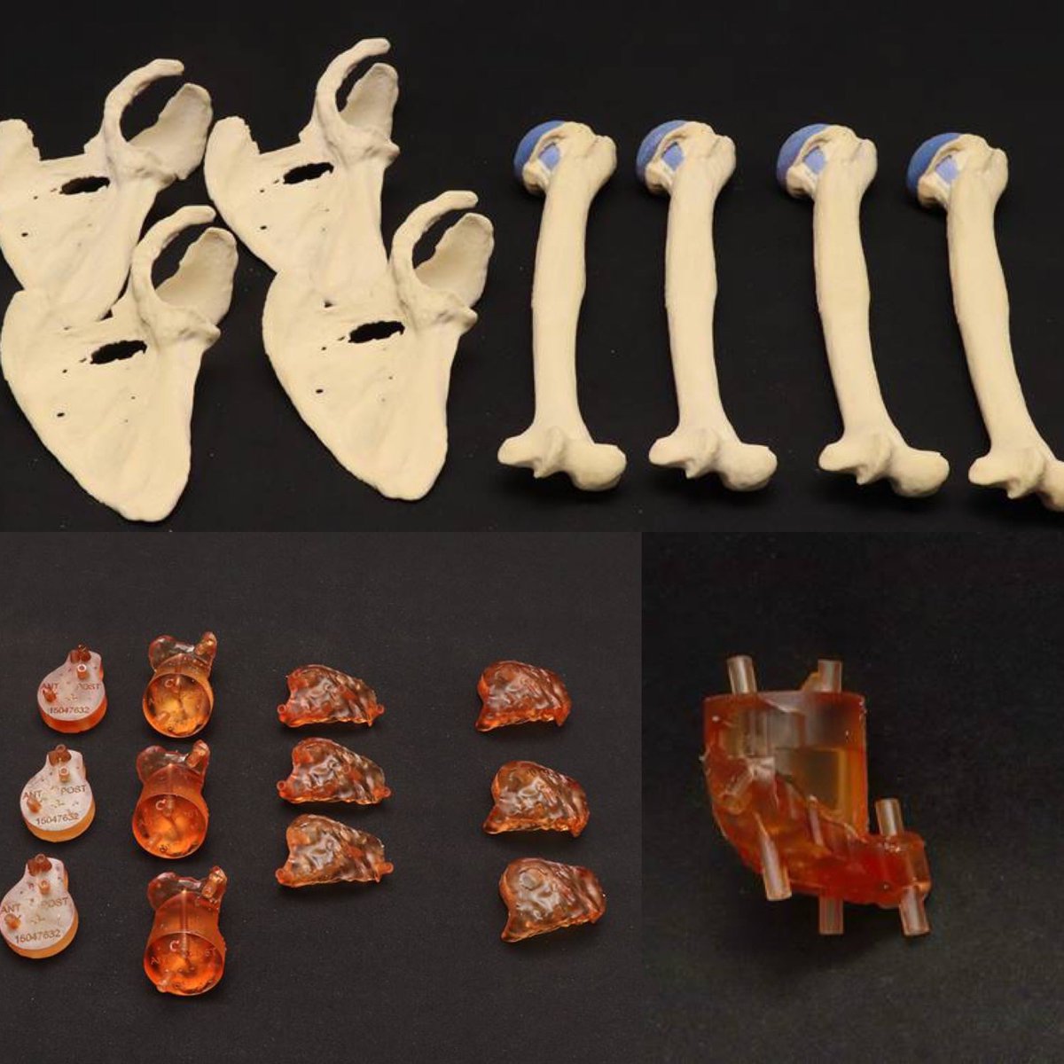 JayMorris_MD's tweet photo. Engineers becoming part of the clinical team makes treatments possible in real time. @hunterdickens9 works closely w/ Dr Mark Morrey @MayoOrtho to provide custom #3Dprinted surgical guides for complex #shoulder reconstructions manufactured in house. #orthotwitter @MayoInnovation https://t.co/2AGDqUufqy