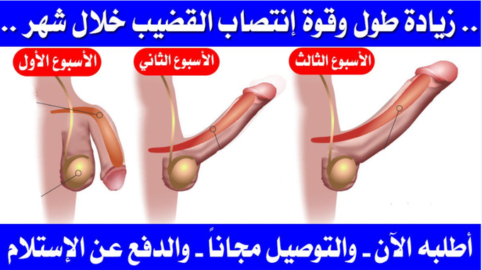 juanamartich93's tweet image. 💞💞علاج صغر حجم العضو الذكري صار متوفر💞💞
💞💞
💞💞 وبيوصلك لباب البيت 💞💞
💞💞
💞💞نتائج مضمونة والتجارب خير برهان 💞💞
💞💞
💞💞متابعة يومية من اخصائية جنسية 💞💞

#الَزٍيُن_ام_مكٌنِسَه

لمزيد من التفاصيل كلمني واتساب في التعليق الأول💞