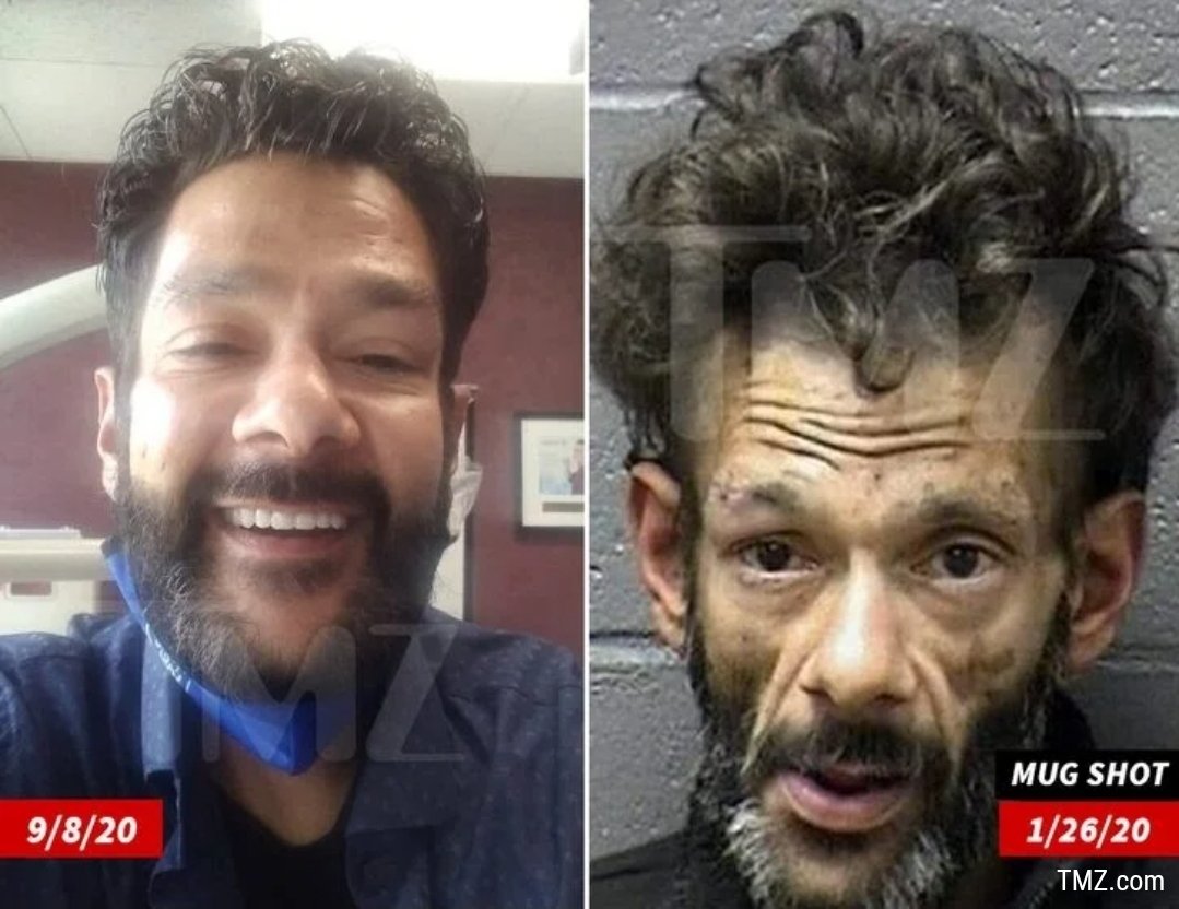 Shaun Weiss (Goldberg) got new teeth and is 256 days sober. Good for him 👍.
📸: TMZ