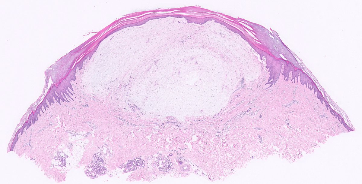 Lorand Kis tweet media