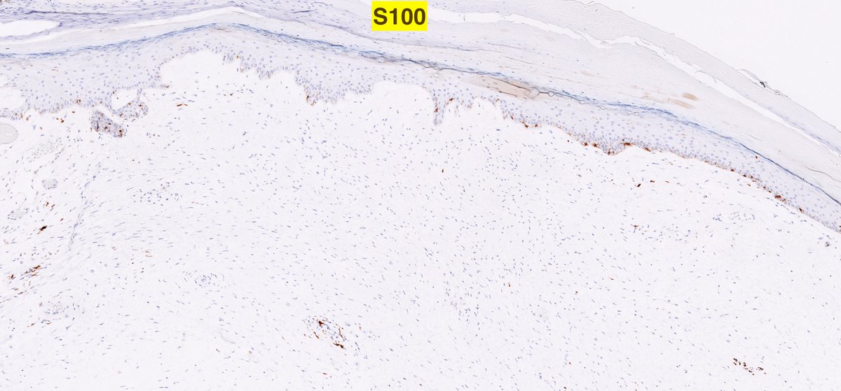 Lorand Kis tweet media