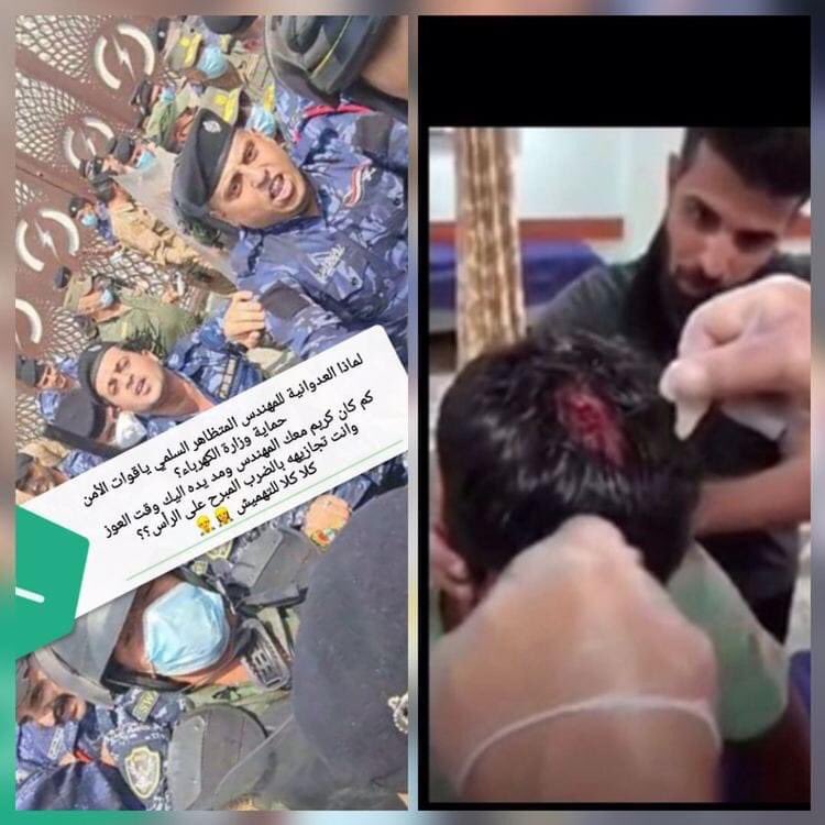 وزارة الكهرباء .. وزارة الفساد تدفع نعاجها من المنتسبين لضرب المهندسين السلميين المعتصمين امام الوزاره <a href="/MAKadhimi/">Mustafa Al-Kadhimi مصطفى الكاظمي</a>  <a href="/IraqiPMO/">المكتب الإعلامي لرئيس الوزراء 🇮🇶</a>  #الكهرباء_تدمي_مهندسيها