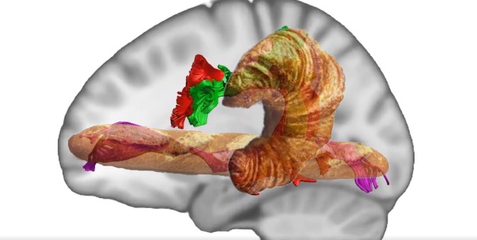 well yes but I believe a stronger correlation lies somewhere else: