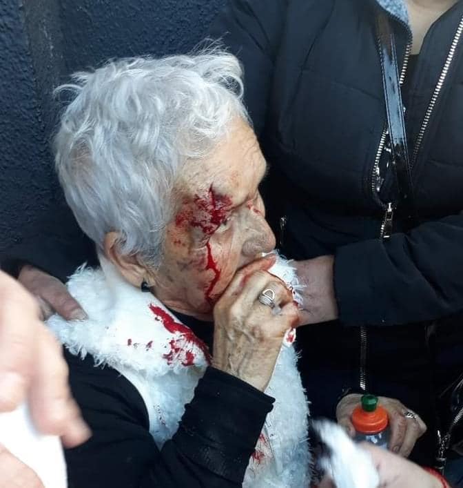 Anciana brutalmente agredida por la policía colombiana. Normal que a los medios de aquí no les escandalice, tampoco lo hacen cuando aquí las golpean para desahuciar, las exterminan abandonadas en residencias lamentables o las golpean para impedir un referéndum democrático.