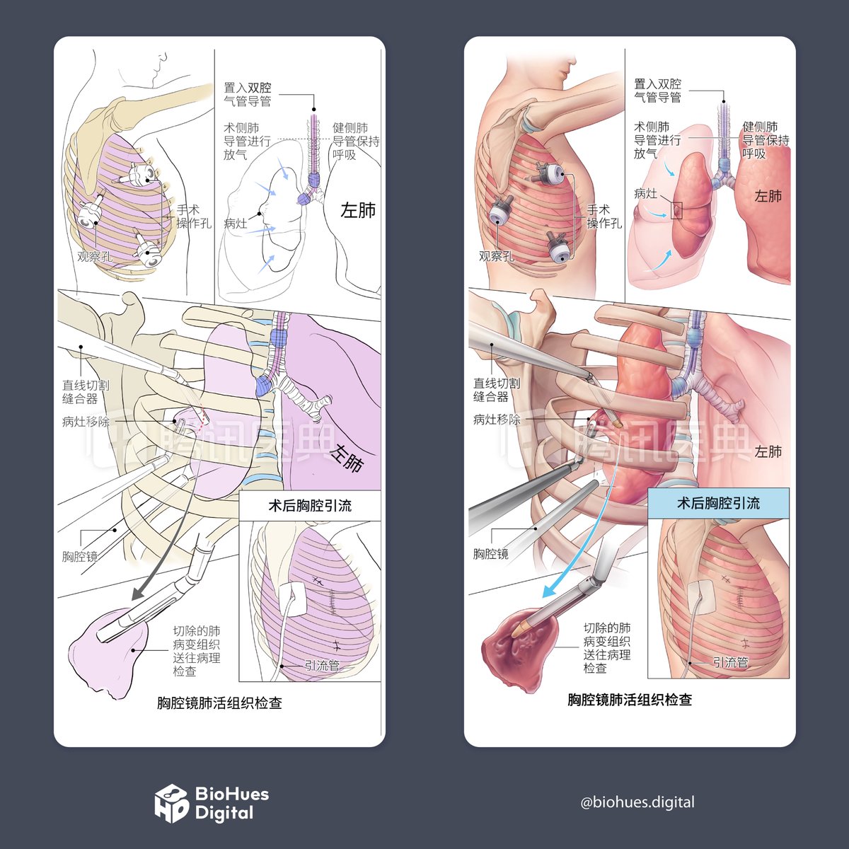 BIOHUES DIGITAL tweet media