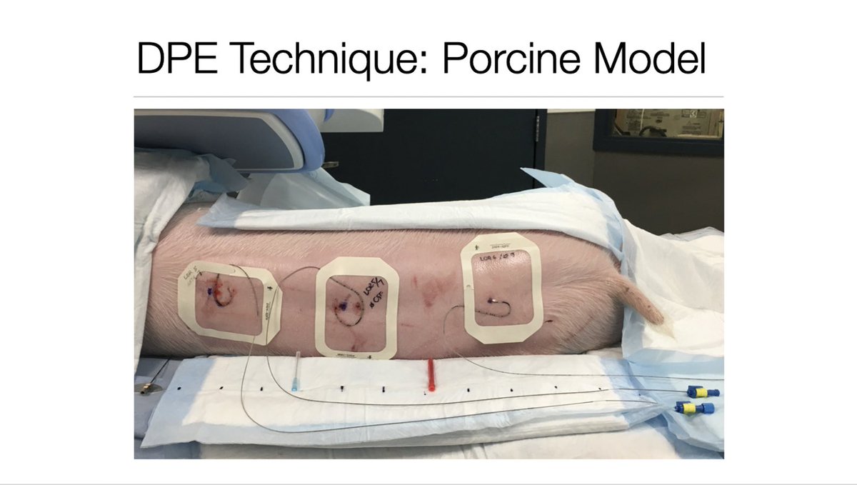 SOAPHQ's tweet image. #GertieMarx #8 - Bushra Taha from @BrighamOBAnes @Harvard  - #SOAPAM2020