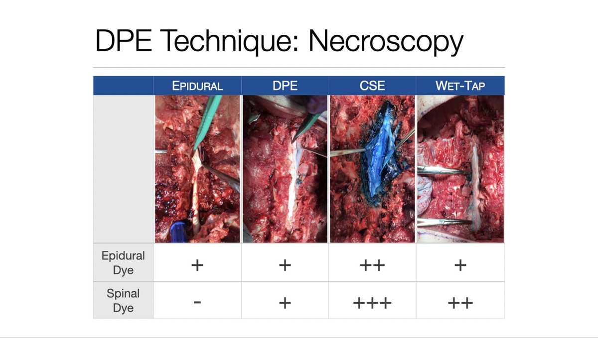 SOAPHQ's tweet image. #GertieMarx #8 - Bushra Taha from @BrighamOBAnes @Harvard  - #SOAPAM2020