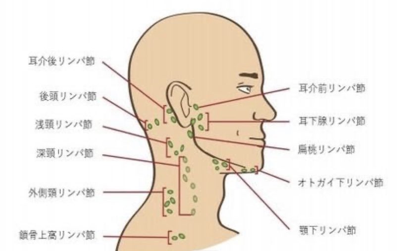 高田 世莉菜 最近アニヲタ気味 医療系に詳しい方に聞きたいのですが オトガイ下リンパ節 に 丸いしこり 腫れ ができてきて 触ったらちょっと痛いので 病院行きたいのですが 何科行けばいいかな 顎下真ん中あたりでちょうど 骨と骨の間あたり 高田 世莉菜 最近アニヲタ気味 医療系に詳しい方に聞きたいのですが オトガイ下リンパ節 に 丸いしこり 腫れ ができてきて 触ったらちょっと痛いので 病院行きたいのですが 何科行けばいいかな 顎下真ん中あたりでちょうど 骨と骨の間あたり