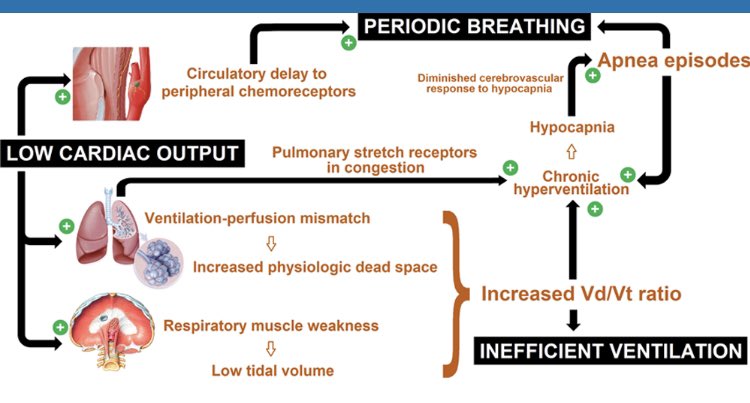 Andrew J Sauer MD (@andrewjsauer) on Twitter photo How does cardiac output derangement contribute to ventilatory inefficiency (VE/VCO2) Love this figure <a href="/FH_Verbrugge/">Frederik H. Verbrugge</a>. Great, really great review in <a href="/AHAScience/">AHA Science</a> <a href="/CircHF/">Circ: Heart Failure</a> <a href="/JHMontfort10/">Jaime Hernandez-Montfort</a> <a href="/RyanTedfordMD/">Ryan J Tedford MD</a> <a href="/ShashankSinhaMD/">Shashank Sinha, MD, MSc, FACC, FAHA, FHFSA</a> <a href="/yaleHFdoc/">Tariq Ahmad MD MPH</a> <a href="/hvanspall/">Harriette Van Spall, MD MPH 🇨🇦</a> <a href="/ShelleyZieroth/">Shelley Zieroth</a> <a href="/JasonKatzMD/">Jason N. Katz</a> @DrNasrien How does cardiac output derangement contribute to ventilatory inefficiency (VE/VCO2) Love this figure <a href="/FH_Verbrugge/">Frederik H. Verbrugge</a>. Great, really great review in <a href="/AHAScience/">AHA Science</a> <a href="/CircHF/">Circ: Heart Failure</a> <a href="/JHMontfort10/">Jaime Hernandez-Montfort</a> <a href="/RyanTedfordMD/">Ryan J Tedford MD</a> <a href="/ShashankSinhaMD/">Shashank Sinha, MD, MSc, FACC, FAHA, FHFSA</a> <a href="/yaleHFdoc/">Tariq Ahmad MD MPH</a> <a href="/hvanspall/">Harriette Van Spall, MD MPH 🇨🇦</a> <a href="/ShelleyZieroth/">Shelley Zieroth</a> <a href="/JasonKatzMD/">Jason N. Katz</a> @DrNasrien
