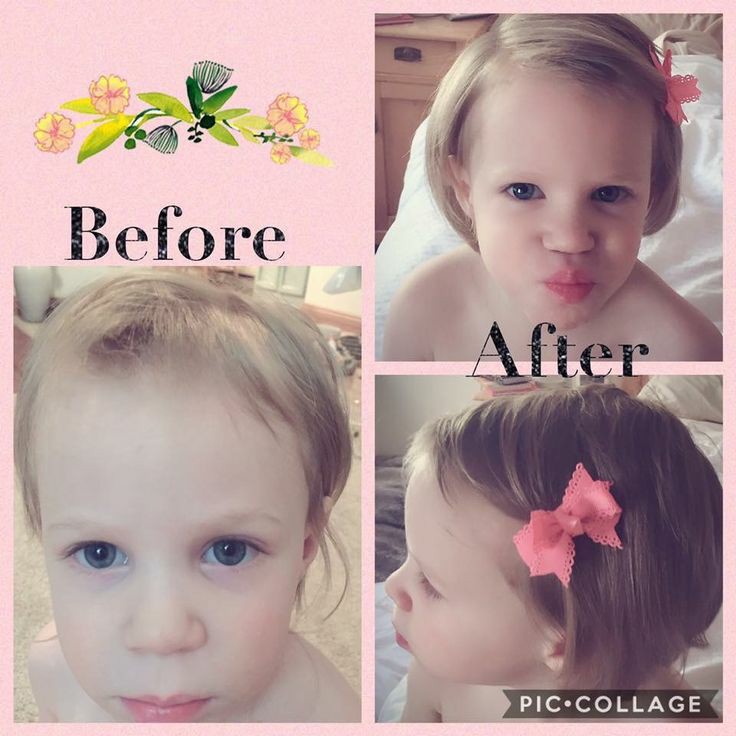 JessBetan20's tweet photo. #ProductosNaturales #crecimentodecabello #vegano #pelosano https://t.co/a9ic90D4XU