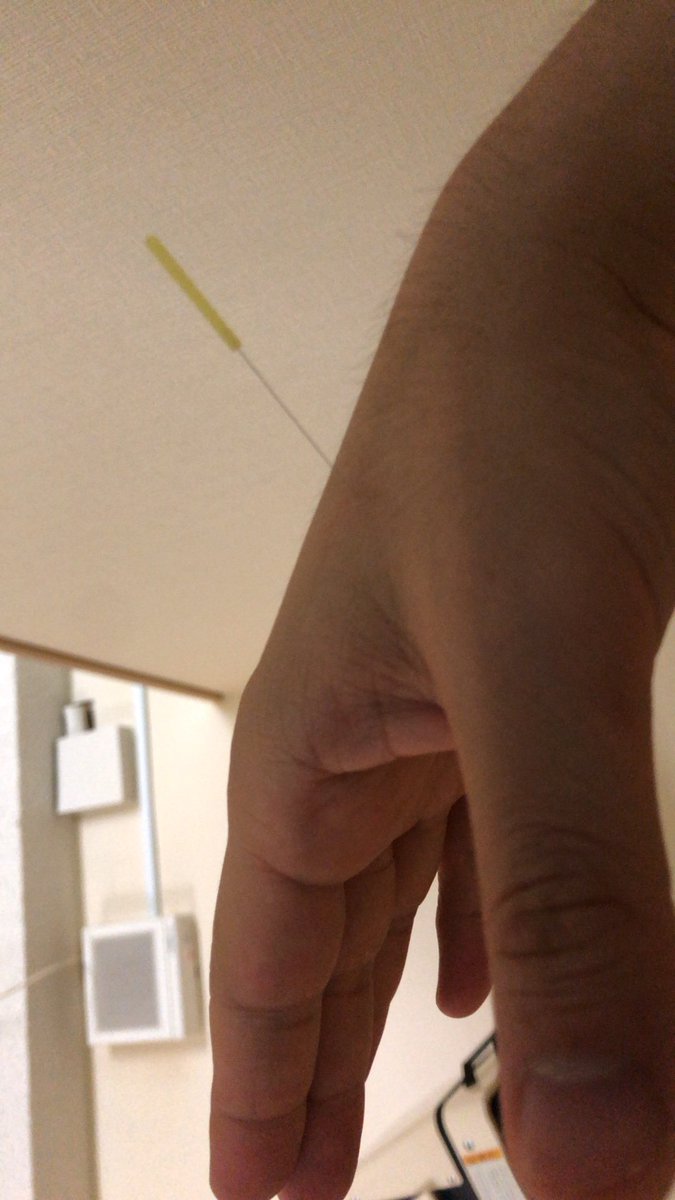 black_mensore's tweet image. シャーーーッ！！！初・鍼治療終了…気になっていた場所が気持ちスッキリしたような…1ヶ月以上前から予約していた甲斐があったな🐍明日の #cc2020 開幕戦名古屋大会では大森シャーーーッ！んと本田選手とトリオ結成！勝利を飾って花道を #GetWild退勤 だ！#ajpw #ajpwtv #蛇バディ