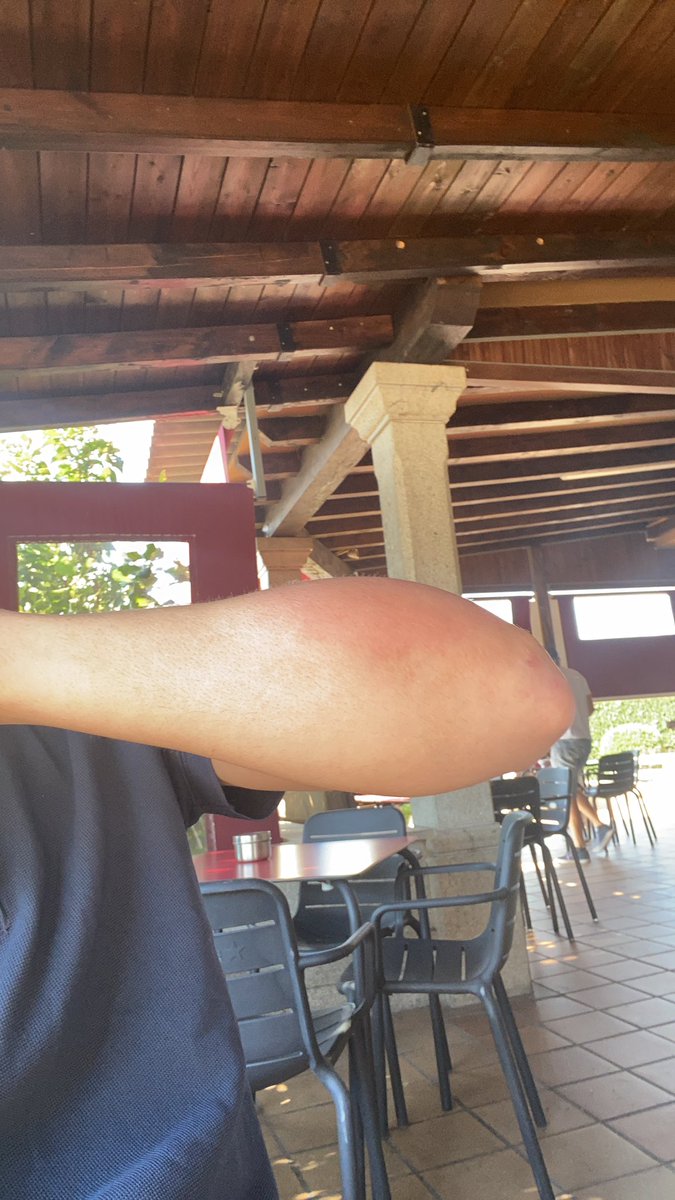 kikerdxx's tweet photo. En la vendimia algo me pico y creo que necesito vuestra ayuda, que puede ser? https://t.co/sEgFAMYXqi