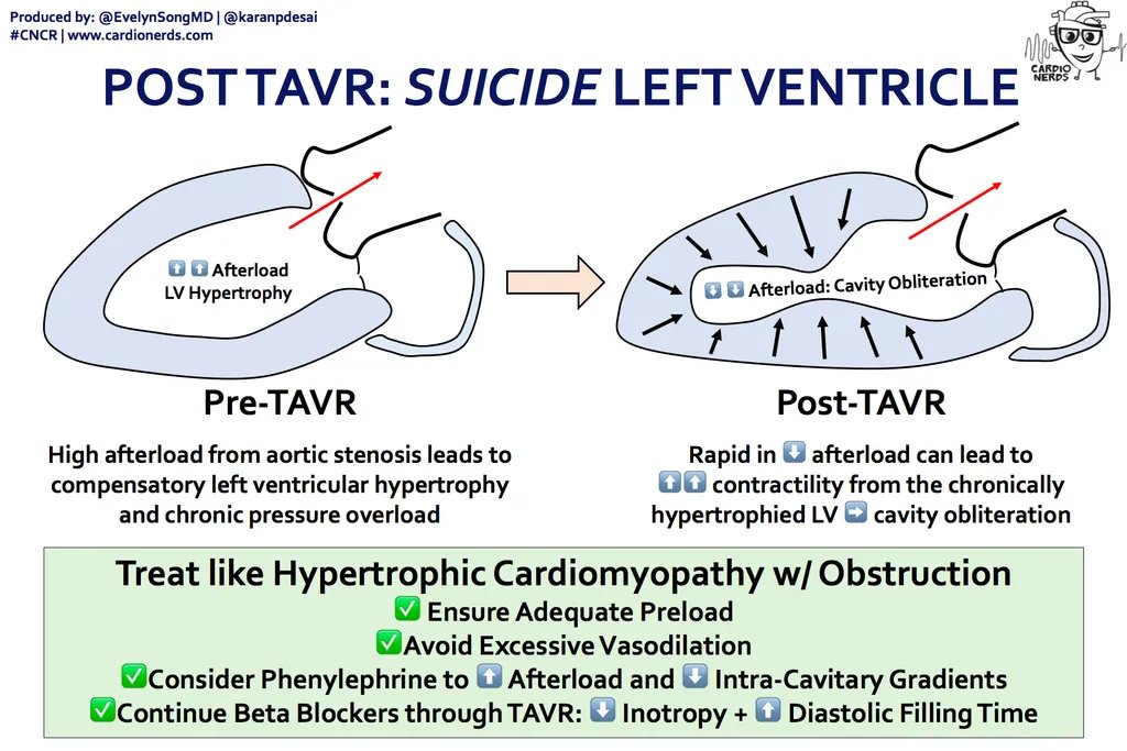 CardioNerds (@cardionerds) on Twitter photo 🔥55. Suicide LV post-TAVR
🚤Join us on a fast-paced speedboat to discuss a fast-paced case about post-TAVR Shock😱
🔝 Teaching by @prkothapalli <a href="/doctormontano/">Sergio A Montaño-Gonzalez Jr, MD</a> @doctormikemg <a href="/DocTravesty/">Travis Benzing</a> @ClayCauthen & Dr. Mark Pirwitz from <a href="/DellMedCardio/">Cardiology Fellowship - UT Austin</a>
cardionerds.com/55-suicide-lv-… 🔥55. Suicide LV post-TAVR
🚤Join us on a fast-paced speedboat to discuss a fast-paced case about post-TAVR Shock😱
🔝 Teaching by @prkothapalli <a href="/doctormontano/">Sergio A Montaño-Gonzalez Jr, MD</a> @doctormikemg <a href="/DocTravesty/">Travis Benzing</a> @ClayCauthen & Dr. Mark Pirwitz from <a href="/DellMedCardio/">Cardiology Fellowship - UT Austin</a>
cardionerds.com/55-suicide-lv-…