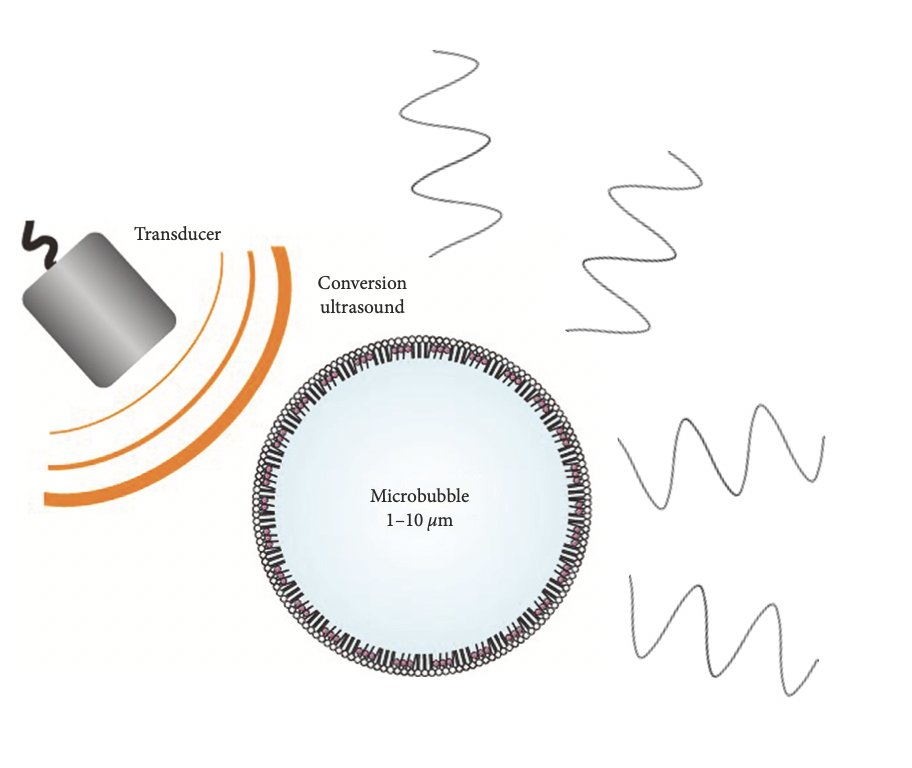 2/ Ultrasound Enhancing Agents (UEAs) are micro bubbles with permeable shells containing a high molecular weight gas, used intravenously for  #echofirst endocardial border delineation.