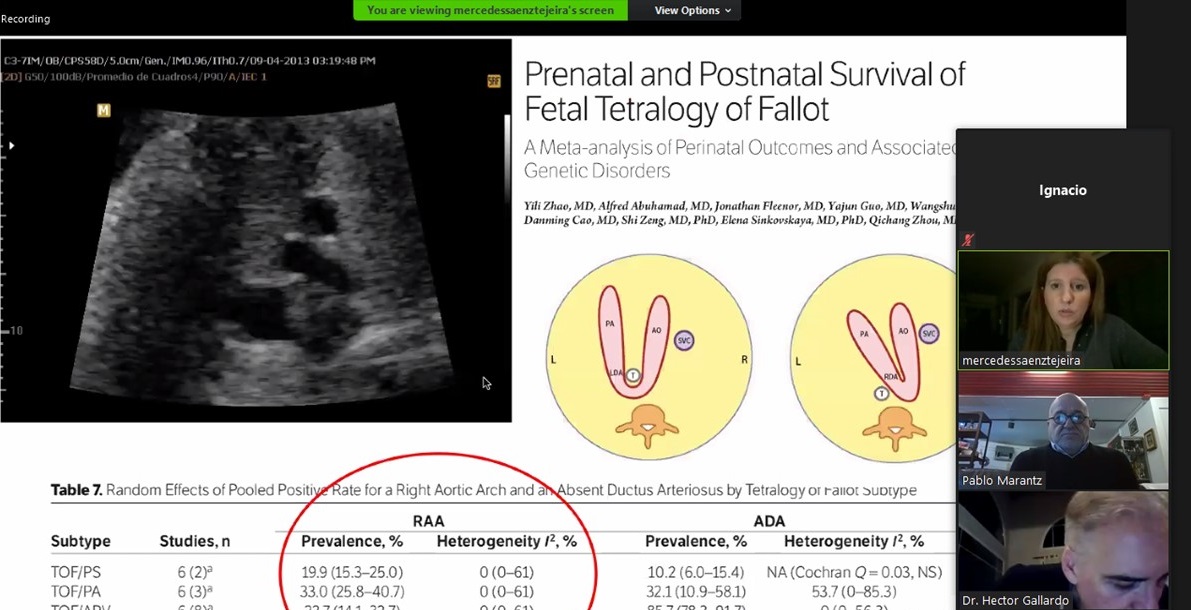 FHospitalaria's tweet image. Ante un muy buen nivel de concurrencia, el pasado 2 de septiembre se realizó vía Zoom una nueva Master Class Online de Ecocardiografía Fetal, auspiciada por Fundación Hospitalaria y organizada por la Fundación Cardioinfantil.
facebook.com/fundhospitalar…