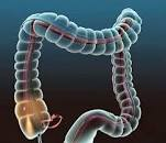 gastroentrolog2's tweet photo. #Colonoscopy helps to view the entire length of the large intestine (colon). It can often help identify abnormal growths, inflamed #tissue, #ulcers, and #bleeding. It involves inserting a #colonoscope, a long, flexible, lighted tube, in through the #rectum up into the colon. https://t.co/t5okJdgtjf