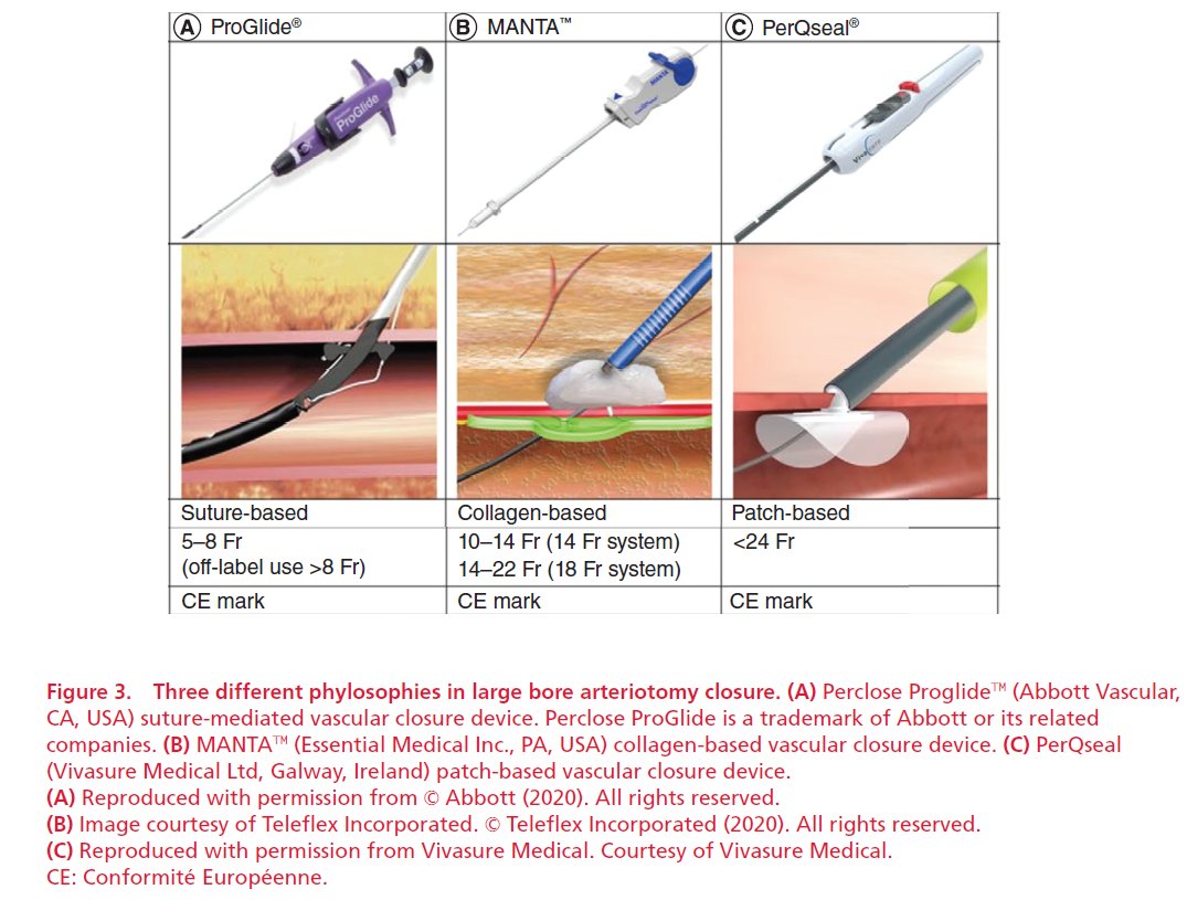 gbiondizoccai's tweet image. Don't miss this comprehensive review on #Perclose #ProGlide: 
Perclose Proglide for vascular closure, by Del Prete et al
futuremedicine.com/doi/10.2217/fc…