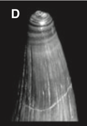 Like the Pleistocene mammal, the name comes from the Greek word for 'wart,' 'nipple,' or 'breast' (there is clearly disagreement in the lit). Jaeger: "this tooth namely is especially distinguished by its teat-like tip." The tip:: Moser & Schoch (2007;  https://bit.ly/2RuOXQN&nbsp;)