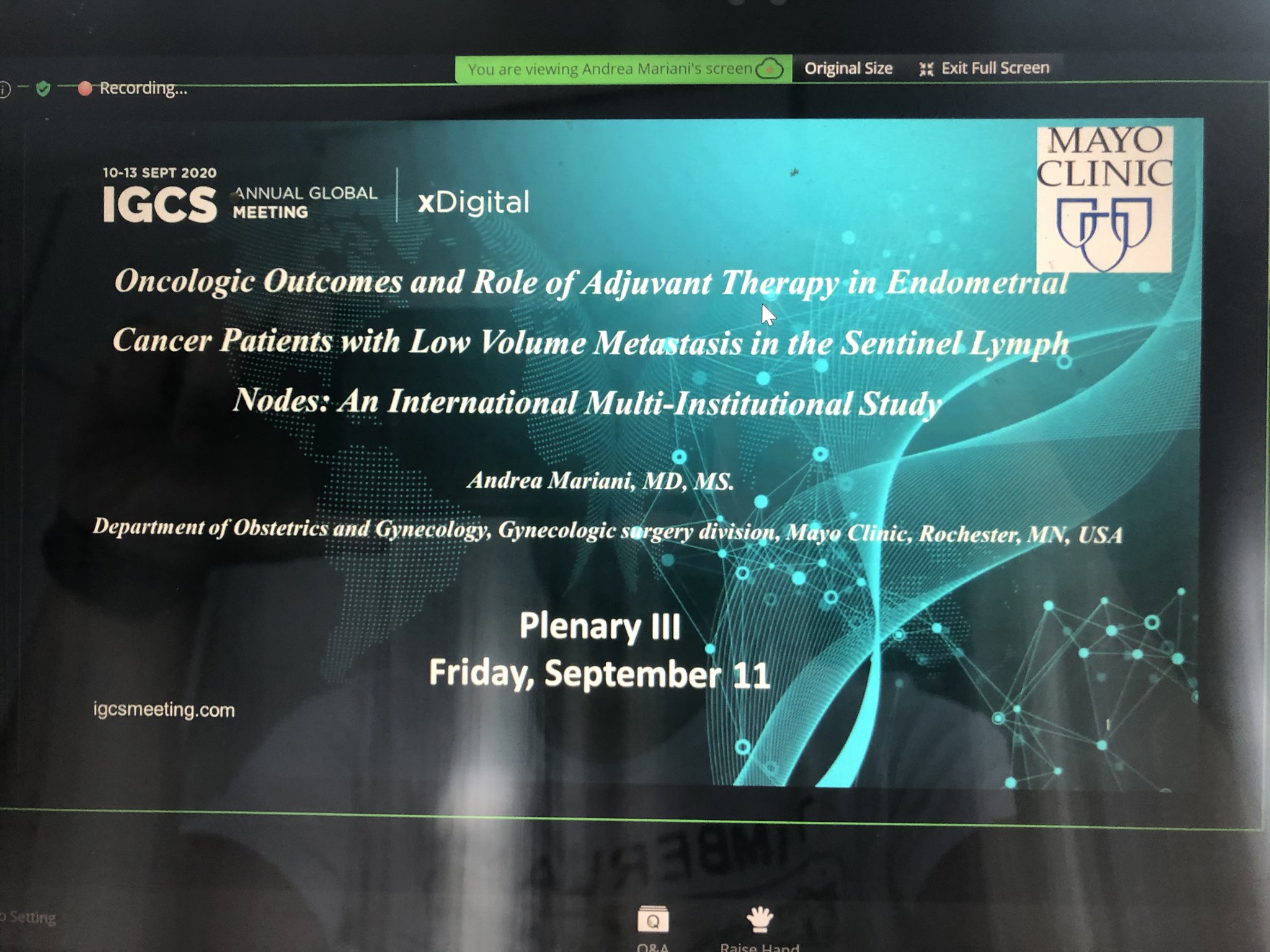 Glauco Baiocchi On Twitter Dr Mariani Mayoclinic Presented Today In Igcsociety Meeting The First Results Of A International Cooperative Study On Low Volume Metastasis In Endometrial Cancer Glad For Being Part Of