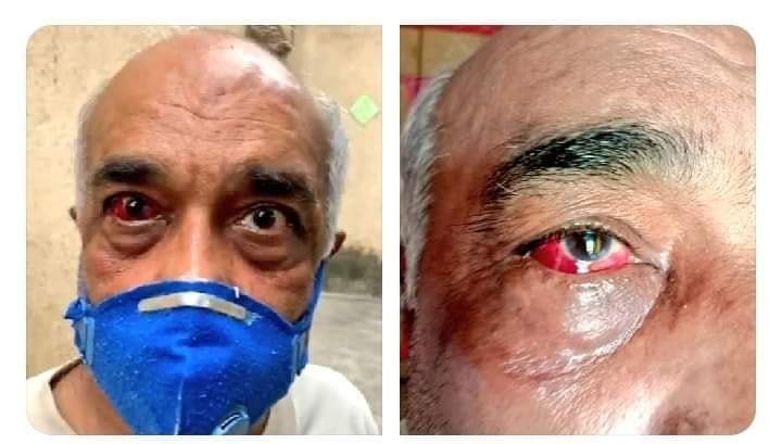iammunishsharma's tweet photo. वाह शिव सेना!!
एक बूढ़े सेनापति पर वार कर कितना सम्मान बढ़ाया आज आपने छत्रपति शिवाजी महाराज का!!
वाक़ई आप “शेर” है!!😠 https://t.co/OTDou287Bs