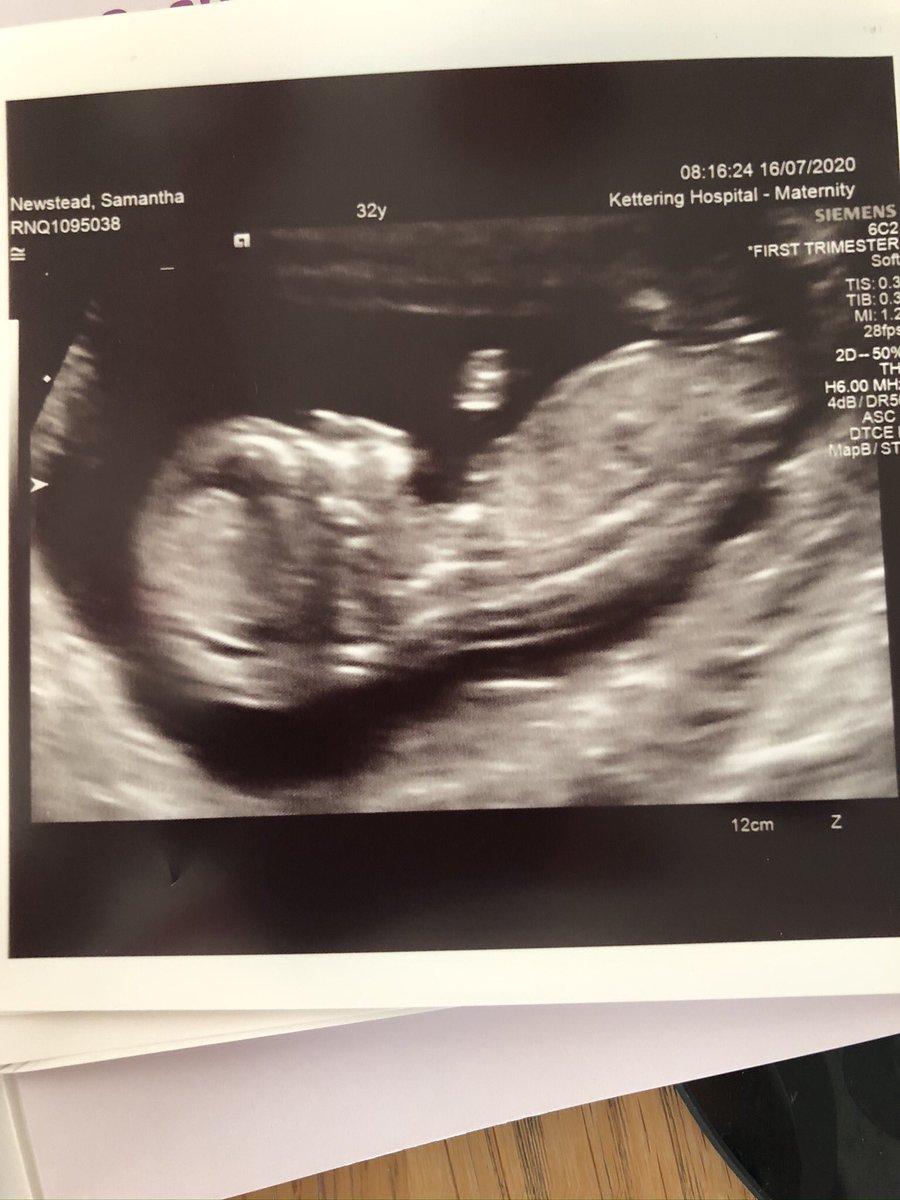 ejnewstead's tweet photo. Dear University Admissions team,
Please can I apply for a deferred place to start in late January 2039?
Kind Regards,
Mr Newstead
π΅πΆπΌ #FutureEnglandNumber9 #ByeByeSleep https://t.co/LJiLbTmei2