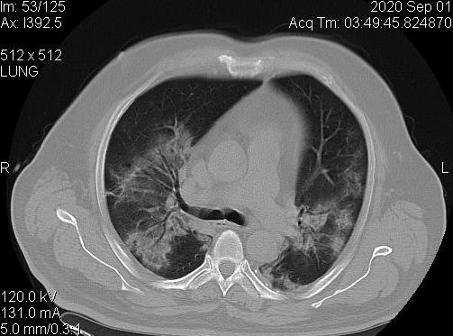 diagnostico911_'s tweet photo. Covid-19 Protocolo en TC uso masivo ante sospecha clínica. https://t.co/UTMFKcwtC3 #resrad #COVID19 https://t.co/SmJbdgdtDa