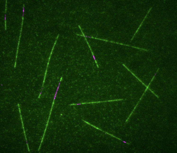 Jayne Aiken (@jayneaiken_) on Twitter photo Very excited to find out I was awarded an #F32 Postdoctoral NRSA Fellowship from <a href="/NINDSFunding/">NINDSfunding</a> today! I’m thrilled to receive support for my project investigating local microtubule and trafficking regulation at synapses 🤓 Very excited to find out I was awarded an #F32 Postdoctoral NRSA Fellowship from <a href="/NINDSFunding/">NINDSfunding</a> today! I’m thrilled to receive support for my project investigating local microtubule and trafficking regulation at synapses 🤓