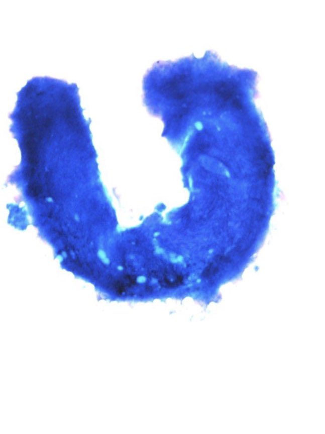 israhkhan's tweet photo. When it comes to imagination nothing can beat cytology smears . From dragons to lucky horse shoe to question marks to dancing figures to an “itch” all have been appreciated in last one week #fnafiday #templepathology @temple_path #cytppath #cytology https://t.co/3DDnp8MAmp