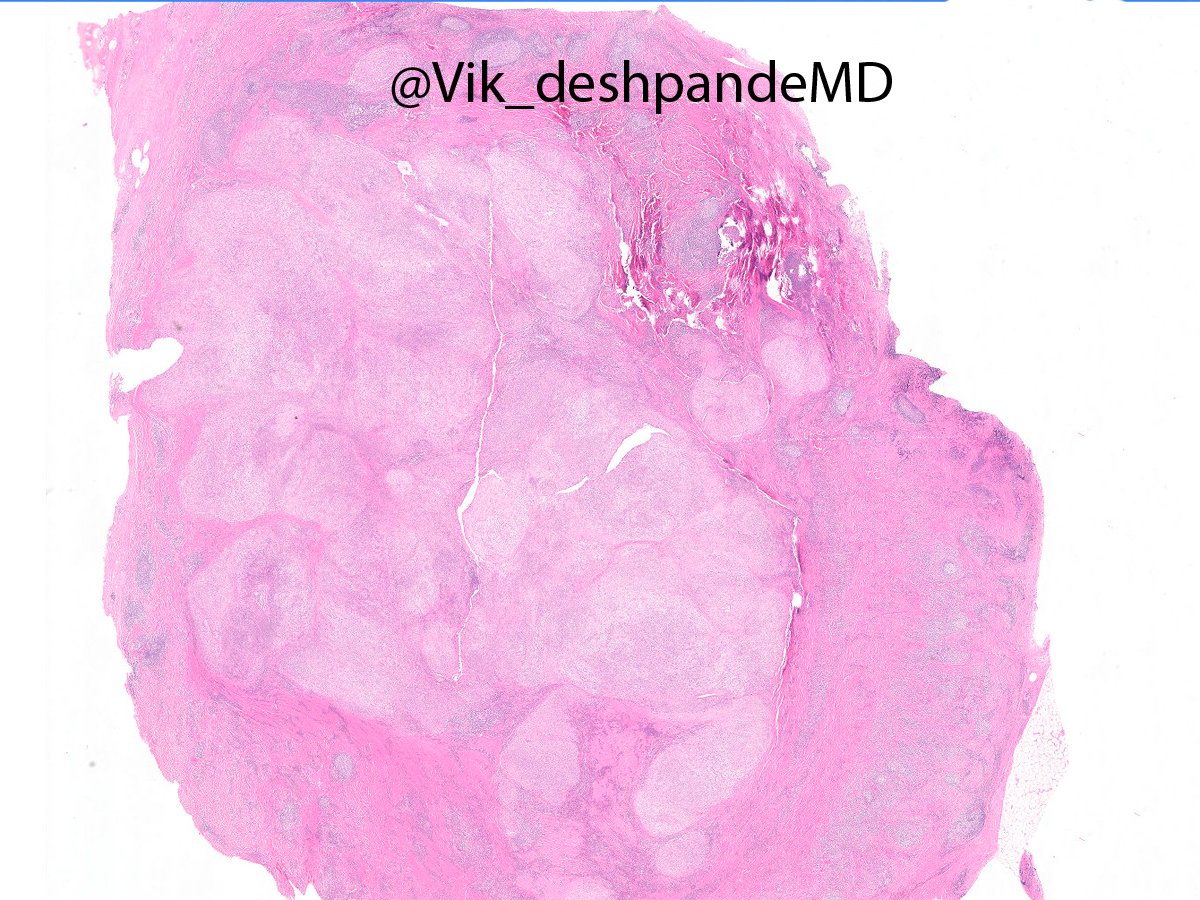 Vikram Deshpande tweet media