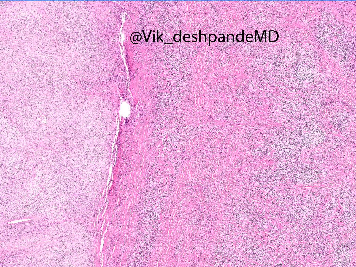 Vikram Deshpande tweet media