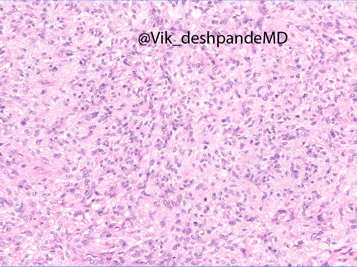 Vikram Deshpande tweet media