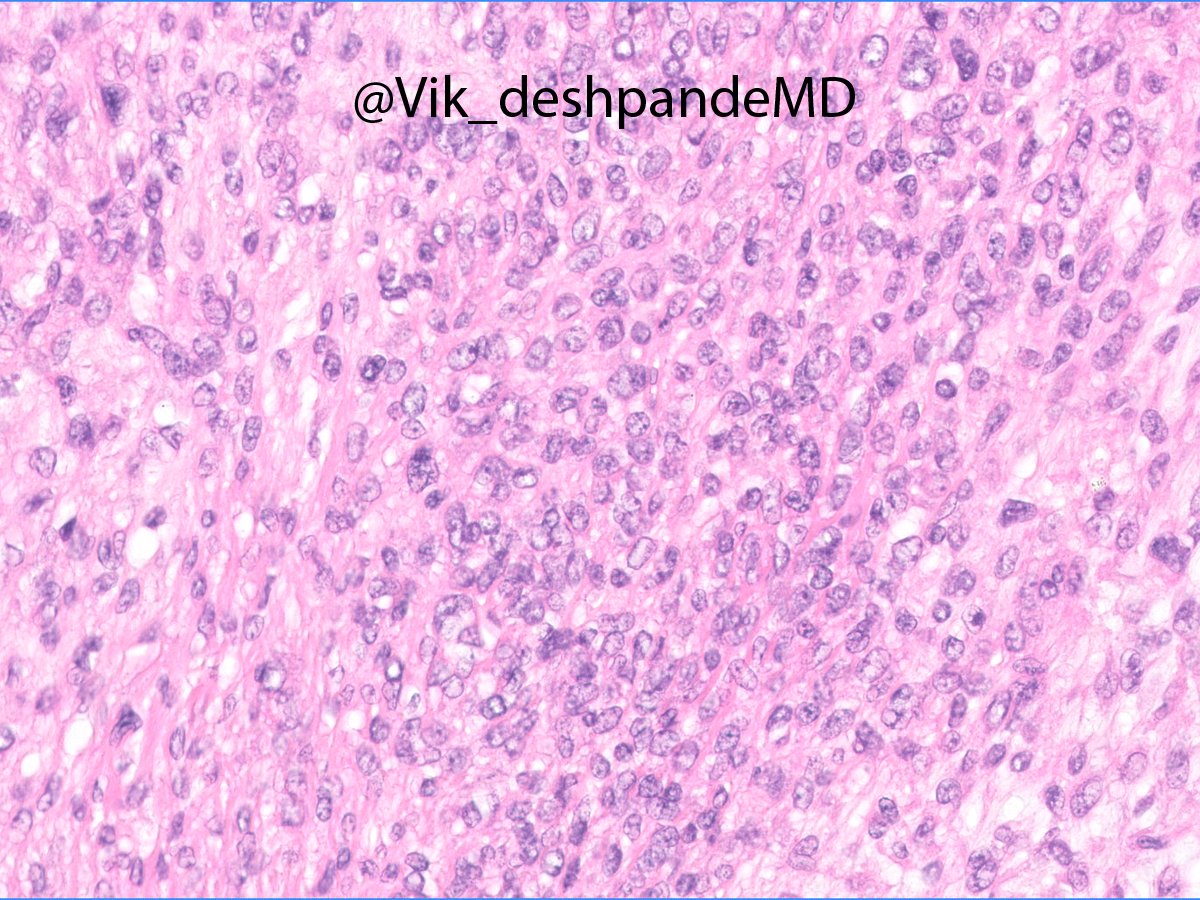 Vikram Deshpande tweet media