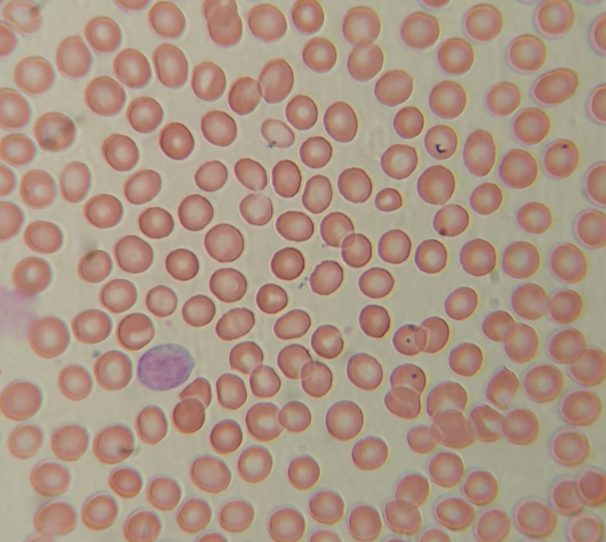 Tal y como lo mencioné antes, las celulas sanguíneas se dividen en tres estirpes -glóbulos rojos o eritrocitos- transportan oxígeno y hemoglobina, -glóbulos blancos o leucocitos- son las células del sistema inmune y las -plaquetas- que son papel fundamental de la coagulacion.