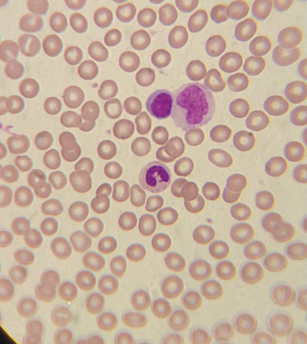 Tal y como lo mencioné antes, las celulas sanguíneas se dividen en tres estirpes -glóbulos rojos o eritrocitos- transportan oxígeno y hemoglobina, -glóbulos blancos o leucocitos- son las células del sistema inmune y las -plaquetas- que son papel fundamental de la coagulacion.