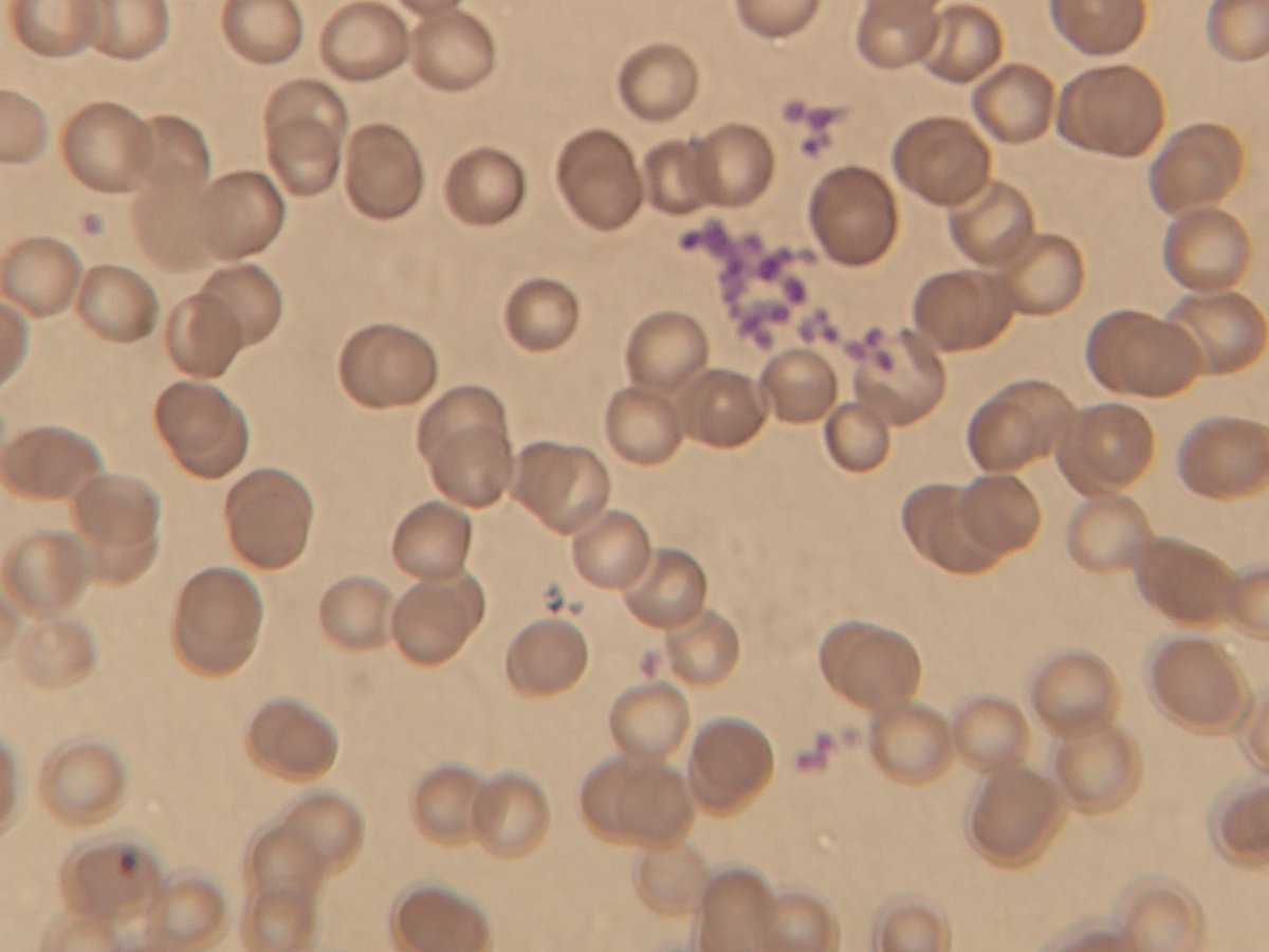 Tal y como lo mencioné antes, las celulas sanguíneas se dividen en tres estirpes -glóbulos rojos o eritrocitos- transportan oxígeno y hemoglobina, -glóbulos blancos o leucocitos- son las células del sistema inmune y las -plaquetas- que son papel fundamental de la coagulacion.
