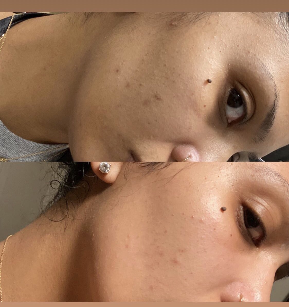 Our gorgeous client has been using our turmeric scrub and literally life moisturizer consistently and she is absolutely glowing AND the after picture is BEFORE moisturizing! Amazing!  
Beautybeginshere3.com

#memphisesthetician #memphisskincare