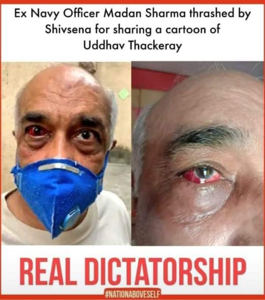 This is what we call Fascism😡 An Ex Navy has been attacked brutally by #ShivaSena goons for no reason.Wen u go against the highest civilians who served our country unconditionally, U are traitor to this nation
@avm_pranaysinha @dharmvir_9 #DemocracyAtStake
#UdhavThackerayresign