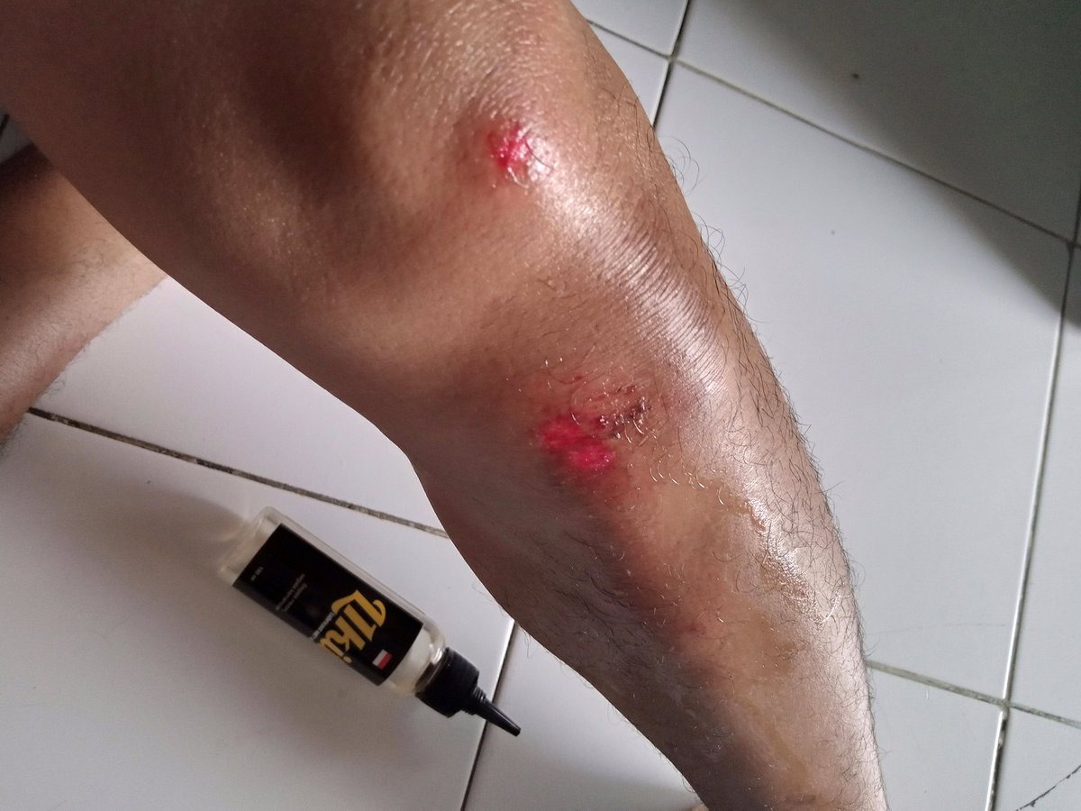 Bukti nyata bacotan <a href="/l1kit/">L1kit</a>  sama gombalnya <a href="/IFnubia/">IF</a> .. 
No pain No game..

Bungsrut lagi nyepedah keserempet bebek metik.. asuu!