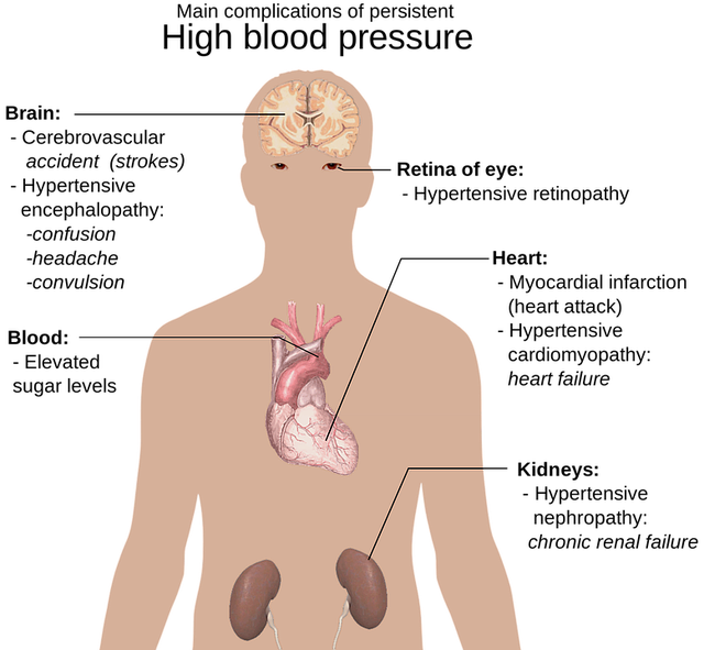 OurDailyHealth1's tweet photo. HIGH BLOOD PRESSURE: Cause, Symptoms &amp; Treatments
#BloodPressure 
#HighBloodPressure
https://t.co/jXaPWLeDTI
For more information, visit the site
https://t.co/tKI6Xz7F4j https://t.co/j3gZp53MEp