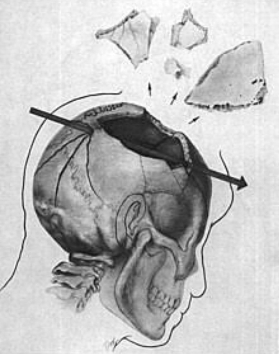 President Johnson would use power from his personal connections in Texas, from the criminal underworld, and from the US government to escape an untimely end in politics and to seize even greater power.